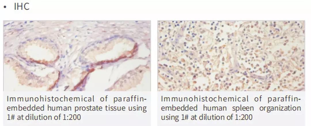 抗體的IHC